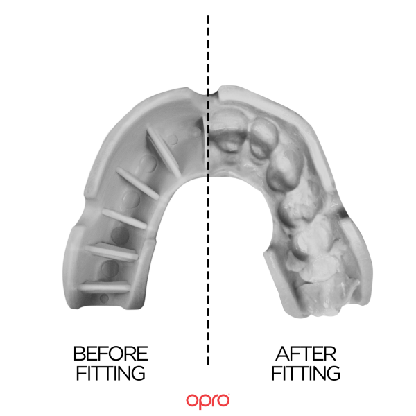 Opro Jnr Bronze Self Fit Mouthguard